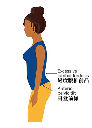 理想骨盆位置 | Ideal Static Pelvic Posture